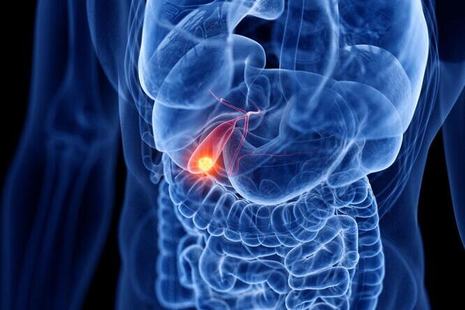 A 3D rendering of the internal organs with the gallbladder shown in red