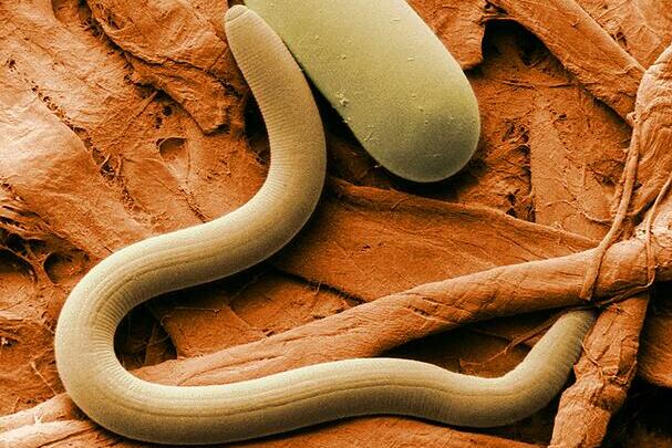 Soybean cyst nematode soybean cyst nematode with egg